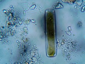 Ansteckung mit Helicobacter
